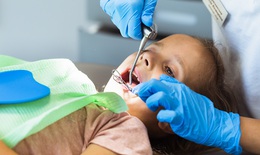 Bật m&#237; những điều cha mẹ chưa biết hết về niềng răng ở trẻ