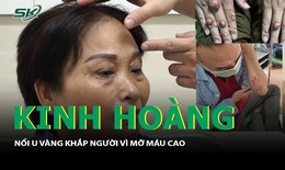 Kinh hoàng 'nổi u vàng' khắp người vì mỡ máu cao