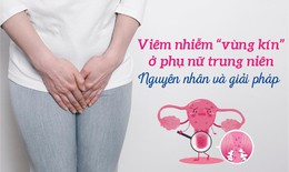 Viêm nhiễm "vùng kín" ở phụ nữ trung niên: Nguyên nhân và giải pháp