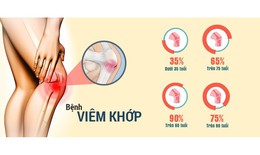 Thực phẩm chức năng hỗ trợ xương khớp n&#224;o được người Nhật tin d&#249;ng?