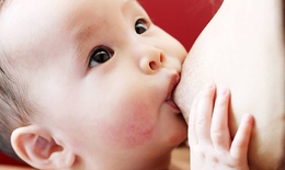 Ph&#242;ng chống suy dinh dưỡng cho trẻ bằng sữa mẹ