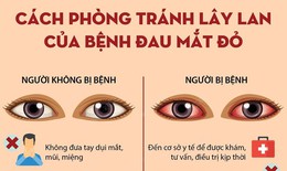 [Infographics] C&#225;ch ph&#242;ng tr&#225;nh l&#226;y lan của bệnh đau mắt đỏ