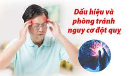 4 dấu hiệu cảnh giác và 4 bước phòng ngừa nguy cơ đột quỵ