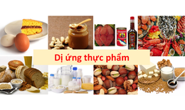 Ph&#226;n biệt dị ứng thực phẩm v&#224; bất dung nạp thực phẩm