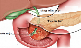 5 loại thực phẩm &#39;giết chết&#39; tuyến tụy