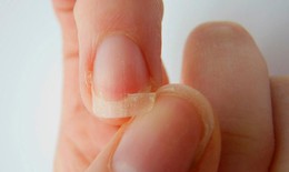 Sơn móng tay nhiều có gây hại không?