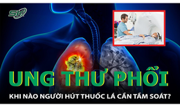 Khi nào nên tầm soát ung thư phổi cho người hút thuốc lá?