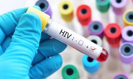5 l&#253; do để bắt đầu điều trị HIV c&#224;ng sớm c&#224;ng tốt