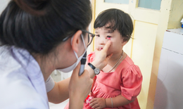 Nghệ An: Gia tăng bệnh nhi đau mắt đỏ, bác sĩ khuyến cáo cách phòng tránh