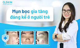 Mụn bọc gia tăng đ&#225;ng kể ở người trẻ