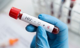 3 lợi &#237;ch từ việc x&#233;t nghiệm HIV sớm