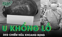 Giải thoát khối u gan nặng 3kg chiếm nửa khoang bụng cho cô gái trẻ
