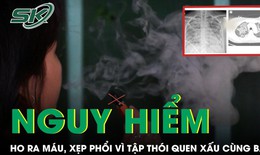 Cô gái ho ra máu, xẹp phổi vì sở thích của nhiều bạn trẻ