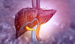 Biểu hiện suy gan cấp v&#224; c&#225;ch điều trị