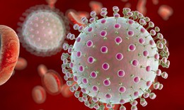 L&#224;o Cai 5 trẻ mắc vi&#234;m n&#227;o virus, cha mẹ cần ph&#225;t hiện sớm căn bệnh n&#224;y