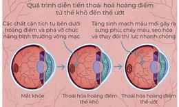 Thoái hóa hoàng điểm tuổi già - đừng bỏ quên đôi mắt mẹ cha