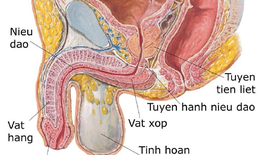Các câu hỏi liên quan đến bệnh viêm tuyến tiền liệt