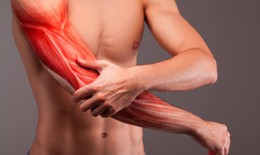 Căng cơ quá mức: Nguyên nhân, triệu chứng, cách điều trị và phòng tránh
