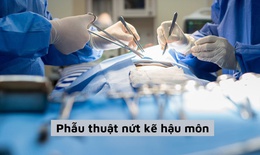 Thuốc v&#224; c&#225;c phương ph&#225;p điều trị nứt kẽ hậu m&#244;n