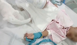 Bé trai 6 tuổi ở TPHCM nghi bị cha tạt nước sôi lên chân
