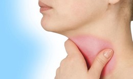 Viêm thanh quản có dẫn đến ung thư không?