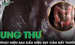 Ph&#225;t hiện ung thư trực tr&#224;ng sau dấu hiệu đau bụng, sụt c&#226;n bất thường