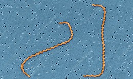Nhiễm xoắn khuẩn Leptospira c&#243; biểu hiện như thế n&#224;o?