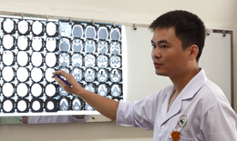 C&#226;u hỏi thường gặp về chấn thương sọ n&#227;o