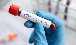 4 giải ph&#225;p thực hiện mục ti&#234;u x&#233;t nghiệm HIV đến năm 2030