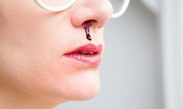 Câu hỏi thường gặp về bệnh giãn mao mạch xuất huyết di truyền