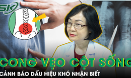 Cảnh b&#225;o những dấu hiệu cong vẹo cột sống ở trẻ cần ph&#225;t hiện sớm