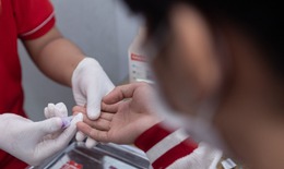 Điều trị đồng nhiễm HIV v&#224; vi&#234;m gan B, C cần lưu &#253; g&#236;?