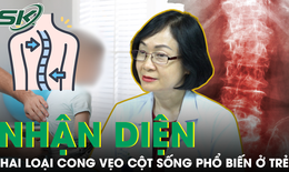 Nhận diện hai loại cong vẹo cột sống phổ biến nhất ở trẻ