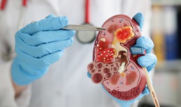 Câu hỏi thường gặp về hội chứng thận hư ở người lớn