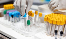 Australia thừa nhận làm mất 300 lọ mẫu virus gây chết người