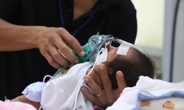 Điều trị thành công cho bé trai bị vòng mạch quấn chèn khí phế quản