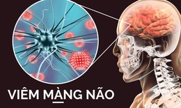 B&#224;i tập n&#224;o tốt cho người vi&#234;m n&#227;o Nhật Bản?