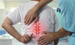 Thuốc điều trị lao cột sống
