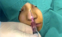 Làm đẹp cấp tốc cuối năm, coi chừng 'mất Tết'