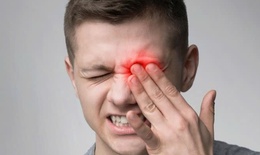 Câu hỏi thường gặp về bệnh viêm dây thần kinh thị giác