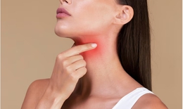Biện pháp tự nhiên giảm nhanh chứng ngứa họng