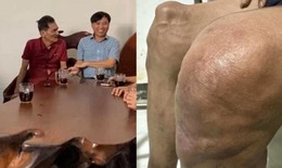 Thương Tín lên Sài Gòn khám bệnh, hình ảnh khiến fan xót xa