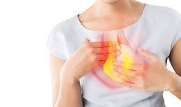 Ợ n&#243;ng do d&#249;ng thuốc trị bệnh khắc phục như thế n&#224;o?