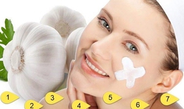 C&#225;ch xử l&#253; mụn bọc sưng đỏ tại nh&#224;