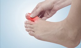Cách phân biệt đau do mắc gout và viêm khớp dạng thấp