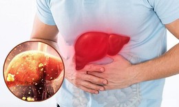 Biến chứng nguy hiểm của tăng men gan
