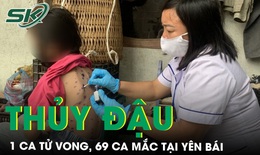 Y&#234;n B&#225;i ghi nhận 69 ca bệnh thủy đậu, 1 trường hợp tử vong