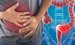 Chuy&#234;n gia khuyến c&#225;o c&#225;ch ph&#242;ng chống bệnh ung thư c&#243; tỷ lệ mắc cao thứ 4 ở nước ta