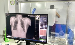 Y tế Quảng Bình nỗ lực trong công tác phòng, chống lao