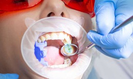 4 cách giúp răng chắc khỏe, ngừa sâu răng